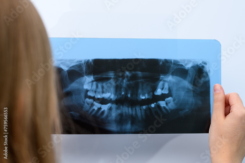 Dentysta trzyma w dłoni zdjęcie rentgenowskie pantomogram zębów 