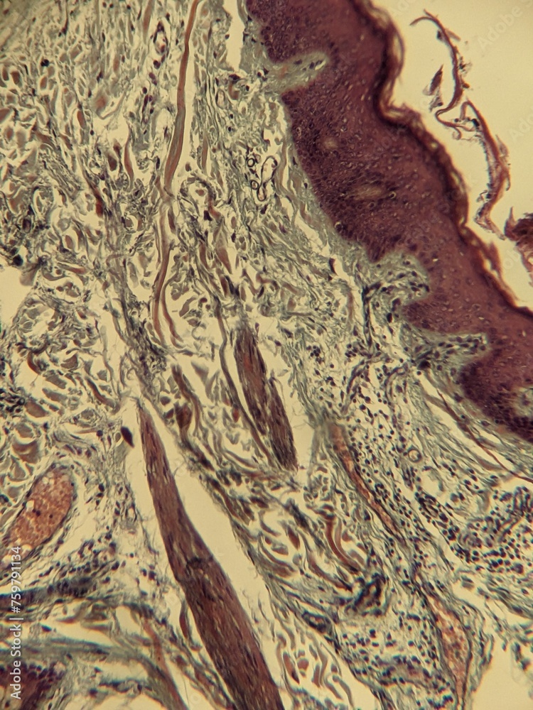 Fototapeta premium microscope slide contain section of human tissue