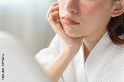 Dermatology, puberty asian young woman, girl looking into mirror, allergy presenting an allergic reaction from cosmetic, red spot or rash on face. Beauty care from skin problem by medical treatment © Pormezz