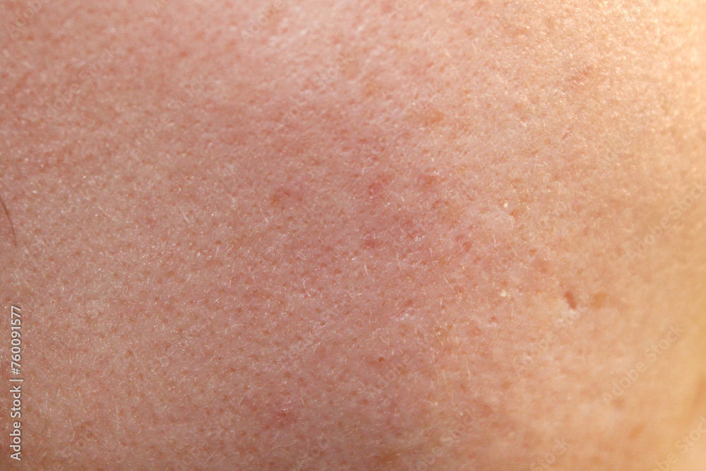 Texture of natural female skin close-up. Stock photo of the body in the best quality.