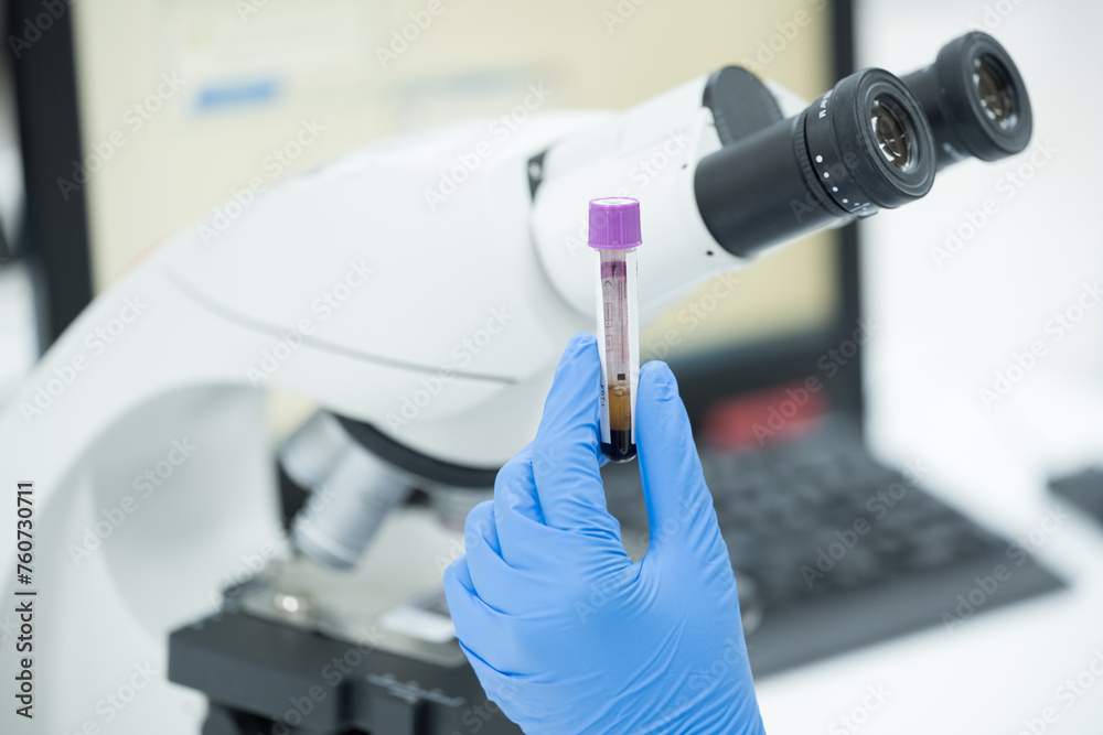 Selective focus technician blue glove hand holding blood test tube for scientist diagnosis and blurry microscope at laboratory department in the hospital. Selective focus technician blue glove hand holding blood test tube for scientist diagnosis and blurry microscope at laboratory department in the hospital.