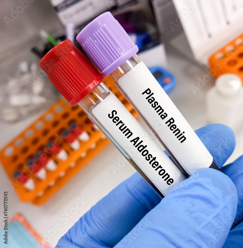 Blood samples for Serum Aldosterone and Plasma Renin test. photo