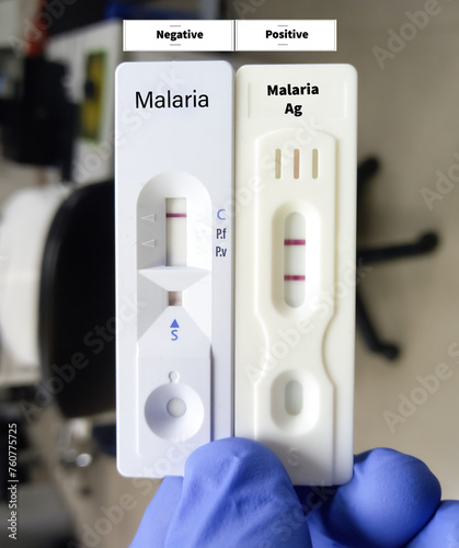 Malarial Parasite(MP) Test, Medical check up test, show positive and negative result on rapid test kit. photo