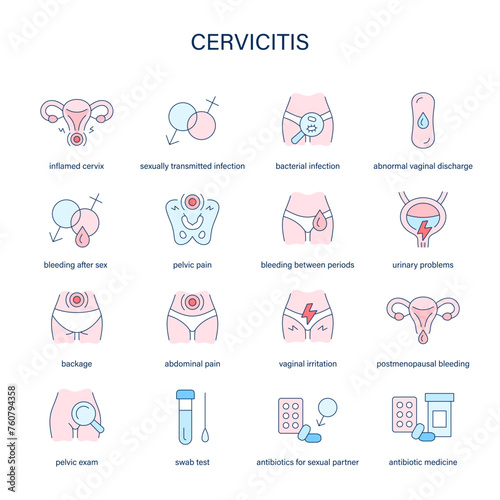 Cervicitis symptoms, diagnostic and treatment vector icons. Medical icons. photo