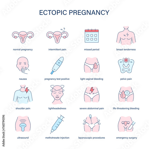 Ectopic Pregnancy symptoms, diagnostic and treatment vector icons. Medical icons.