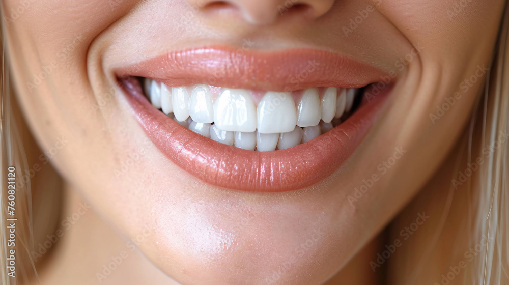 Closeup of beautiful snow-white smile. Ideal strong white teeth, teethcare. Healthcare, stomatological concept for dentists. Only smile on face, fingers near face Closeup of beautiful snow-white smile. Ideal strong white teeth, teethcare. Healthcare, stomatological concept for dentists. Only smile on face, fingers near face