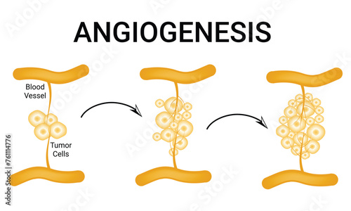 Angiogenesis Science Design Vector Illustration Diagram