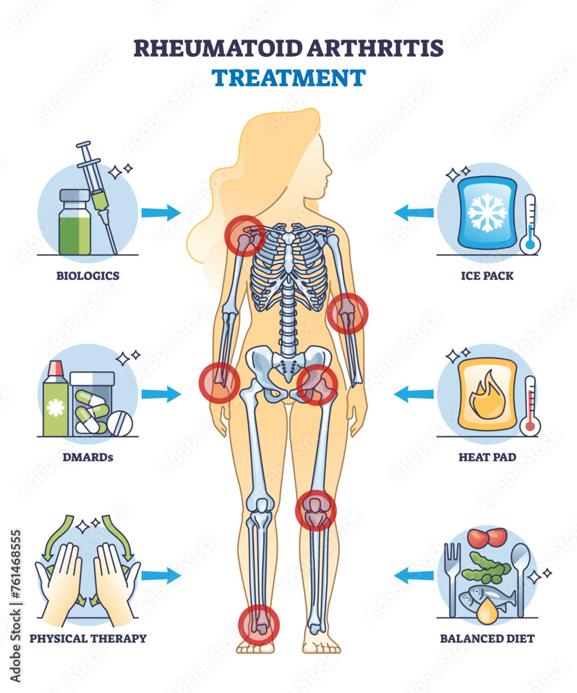 Rheumatoid arthritis treatment and health therapy methods outline ...