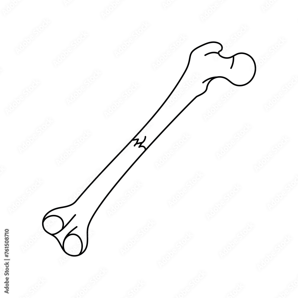 Fototapeta premium Transverse bone fracture line icon.