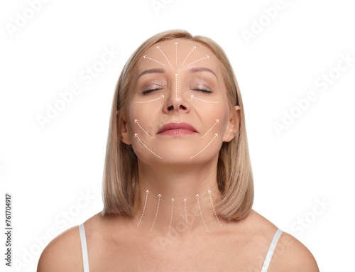 Woman with perfect skin after cosmetic treatment on white background. Lifting arrows on her neck and face © New Africa