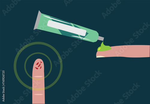 Ointment wound care for a fingertip with blisters or burns. Editable Clip art.