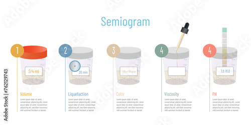 Seminogram consists of studying the semen, volume, liquefaction, color, viscosity and pH. photo