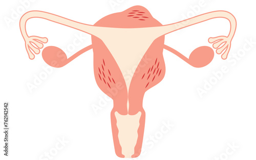 Diagrammatic illustration of adenomyosis, anatomy of the uterus and ovaries photo