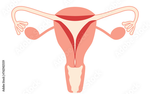 Diagrammatic illustration of endometrial hyperplasia, anatomy of the uterus and ovaries