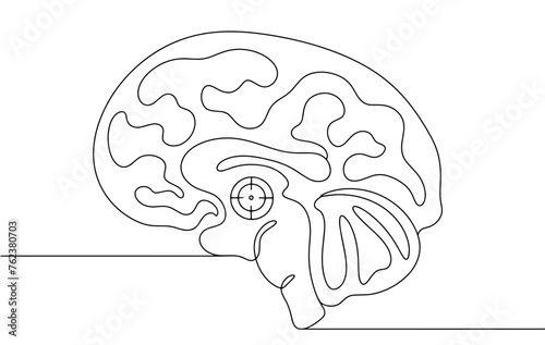 Brain. Parkinson's disease