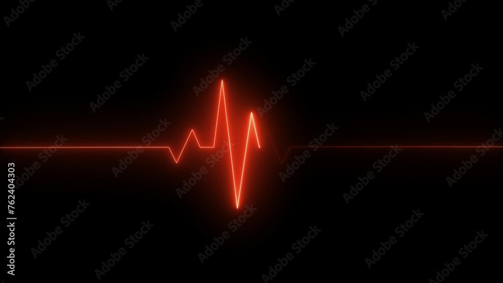 Neon Electrocardiogram Heartbeat Pulse Heart attack monitoring Medical Patient Treatment Display Background Loop. Neon Electrocardiogram Heartbeat Pulse Heart attack monitoring Medical Patient Treatment Display Background Loop.