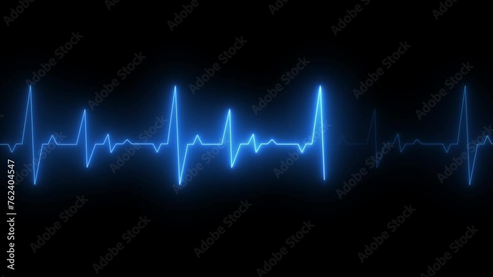 Neon Electrocardiogram Heartbeat Pulse Heart attack monitoring Medical Patient Treatment Display Background Loop. Neon Electrocardiogram Heartbeat Pulse Heart attack monitoring Medical Patient Treatment Display Background Loop.