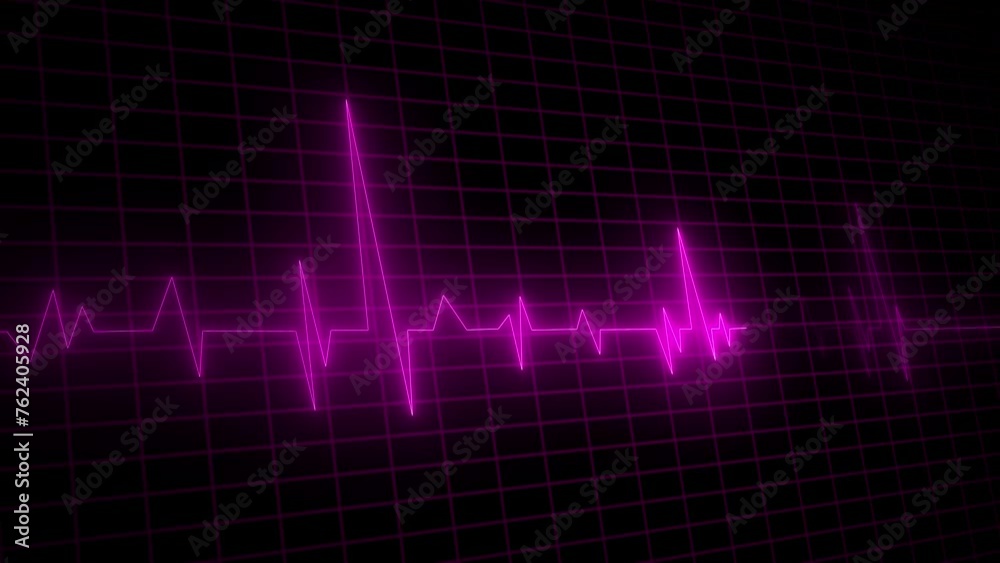 Neon Electrocardiogram Heartbeat Pulse Heart attack monitoring Medical Patient Treatment Display Background Loop. Neon Electrocardiogram Heartbeat Pulse Heart attack monitoring Medical Patient Treatment Display Background Loop.