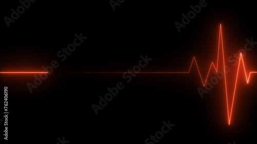 Neon Electrocardiogram Heartbeat Pulse Heart attack monitoring Medical Patient Treatment Display Background Loop. photo