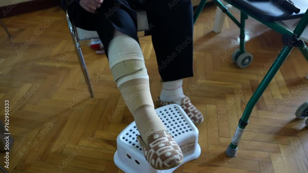 Old woman lifting her pants to show special stockings for blood circulation