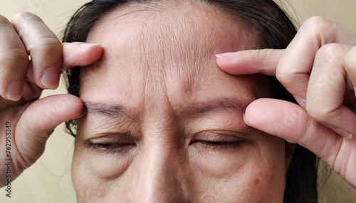 close up of a person with a headache, showing the flabbiness and wrinkle, swelling and ptosis beside the eyelids, dark spots and blemish on the face of the woman, health care and beauty concept. photo