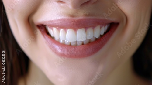 Smiling female mouth with shiny healthy white teeth 