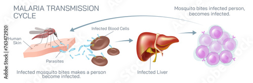 Malaria parasite life cycle and transmission vector illustration.
Life cycle of the malaria parasite
Many factors make malaria vaccine development challenging. Malaria causes, symptoms and treatments. photo