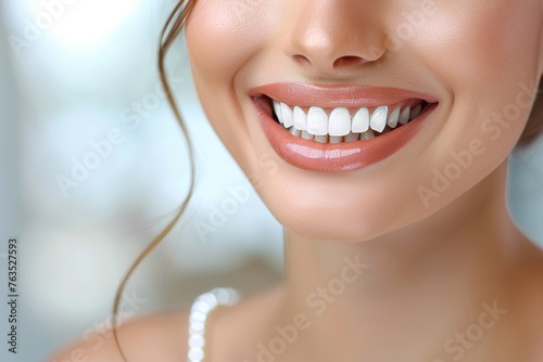 Radiant Smile of a Joyful Woman Showcasing Perfect White Teeth