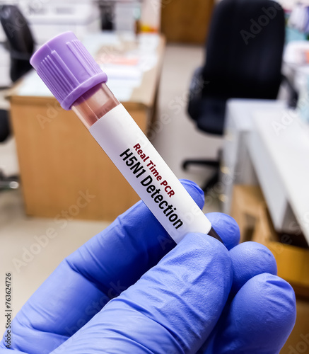 Blood Sample for RT PCR H5N1 test, avian influenza virus (AIV), avian flu or bird flu. photo