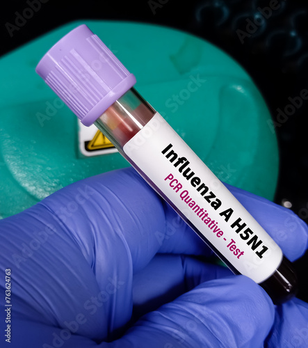 Blood Sample for RT PCR H5N1 test, avian influenza virus (AIV), avian flu or bird flu. photo