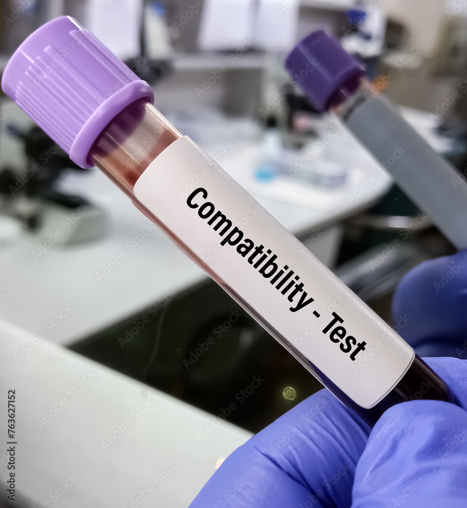 Blood sample for Compatibility test, a matched donor blood with patient blood. blood transfusion.