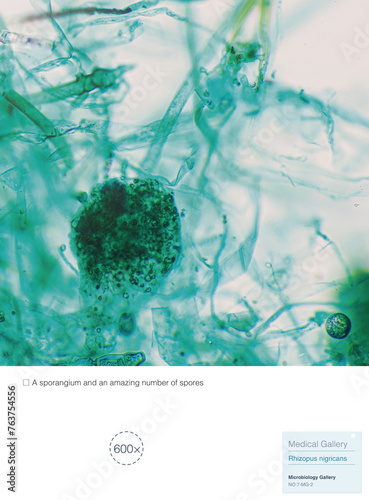 Rhizopus niger is a fungus that is widely distributed on starchy foods such as moldy bread, commonly known as black bread mold. It can be found in both soil and air.
