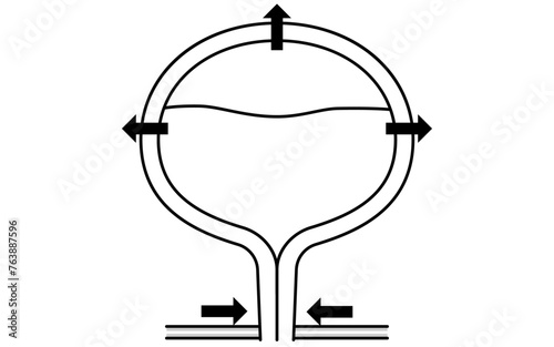 Medical illustration of the normal bladder, how it urinates, and how it stores urine