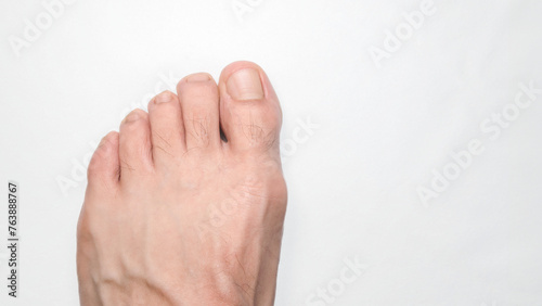Close up of a person left foot toes with white background and space on the right for text