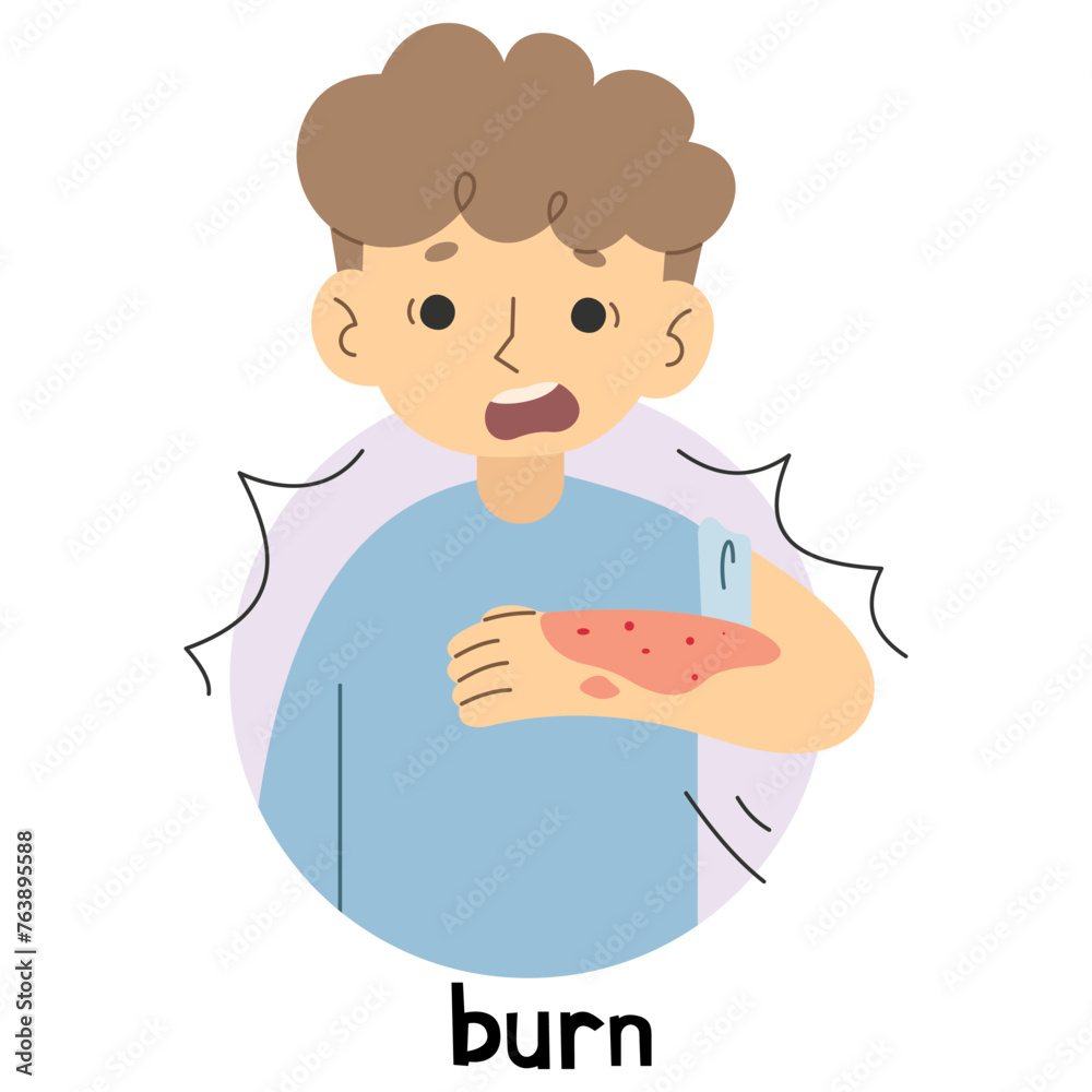 Burn 3 cute on a white background, vector illustration.
