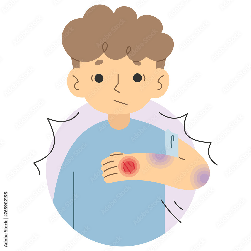 Bruise 4 cute on a white background, vector illustration.
Bruise 4 cute on a white background, vector illustration.