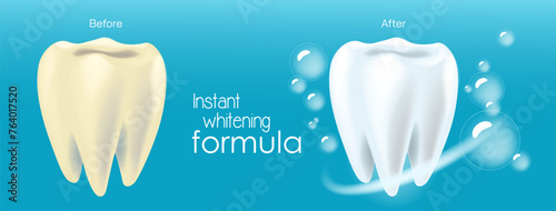 Oral hygiene vector illustration. Dental care. Achieving healthy teeth takes a lifetime of care. Taking care of the teeth and gums. High quality vector images for your clinic.
