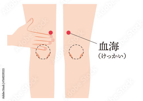 足のツボ　血海
