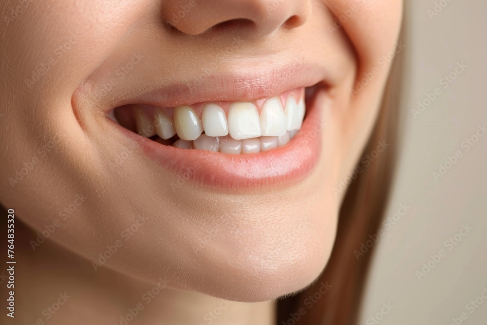 Close-up of a smiling woman showcasing perfect white teeth, denoting health and happiness Close-up of a smiling woman showcasing perfect white teeth, denoting health and happiness