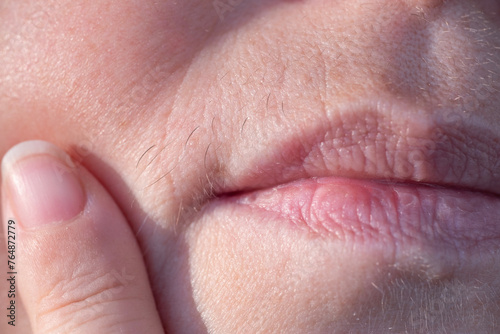 Принти на полотні close-up mature female lips, removes excess facial hair, excessive hair growth,
