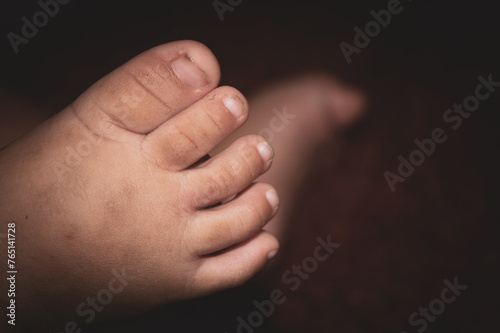 the feet of a baby boy with a complete number of toes © Alkhairyshop