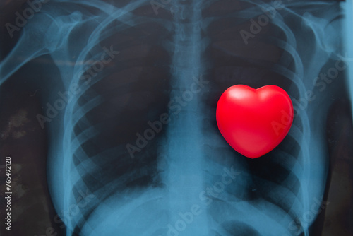 Red heart on x ray chest. photo