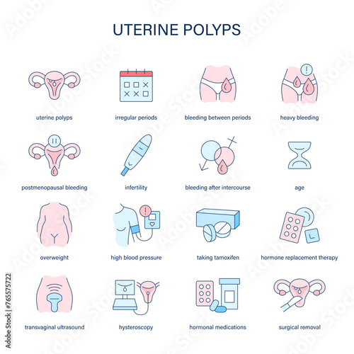 Uterine Polyps symptoms, diagnostic and treatment vector icons. Medical icons. photo