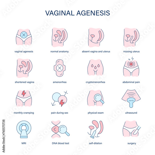 Vaginal Agenesis symptoms, diagnostic and treatment vector icons. Medical icons. photo