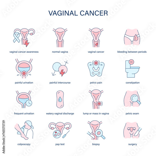 Vaginal Cancer symptoms, diagnostic and treatment vector icons. Medical icons. photo