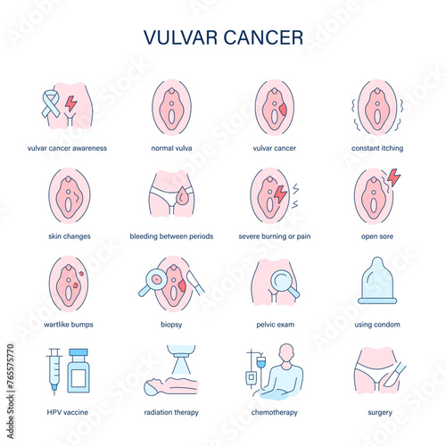 Vulvar Cancer symptoms, diagnostic and treatment vector icons. Medical icons. photo