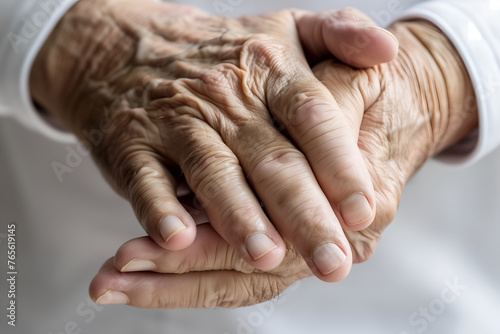 Hand of elder woman. Concept of rheumatoid arthritis, osteoarthritis, or joint pain.