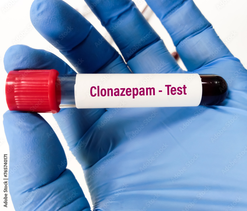 Blood Sample For Serum Clonazepam Label Test To Set Therapeutic Range Or Overdose Toxicity Blood Sample For Serum Clonazepam Label Test To Set Therapeutic Range Or Overdose Toxicity