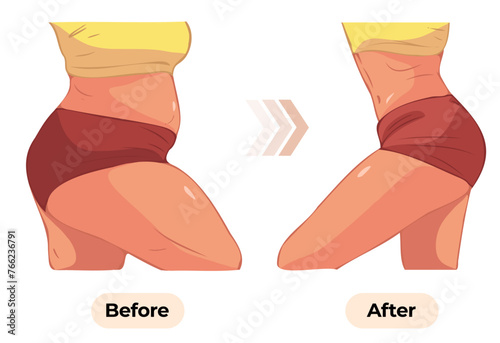 Women's body changes before and after fitness show vector illustrations
