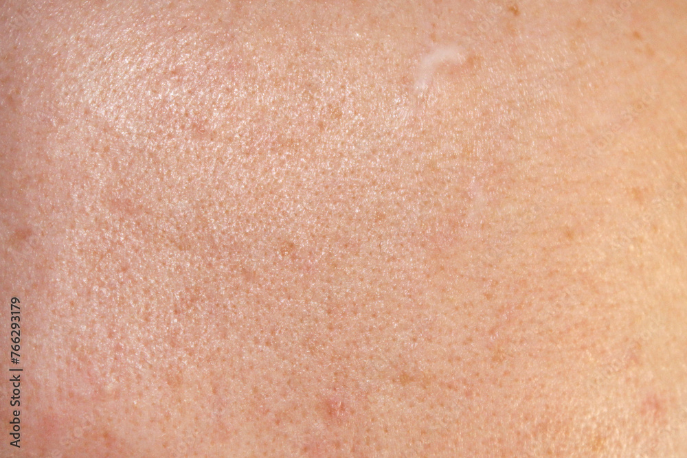 Skin texture and scar. Close-up stock photo of human skin in best quality.